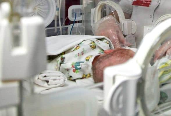 Новорожденного из Серпухова весом 650 граммов выходили в Видном